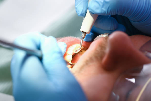 Best Emergency Wisdom Tooth Extraction in Midway, AR