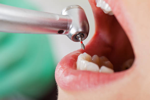 Best Emergency Wisdom Tooth Extraction in Midway, AR
